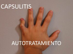 AUTOTRATAMIENTO