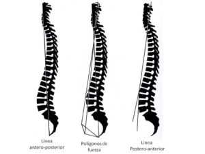 estructural